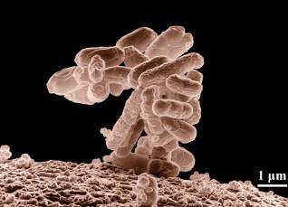 ecoli